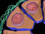 Breast Cancer Cells image